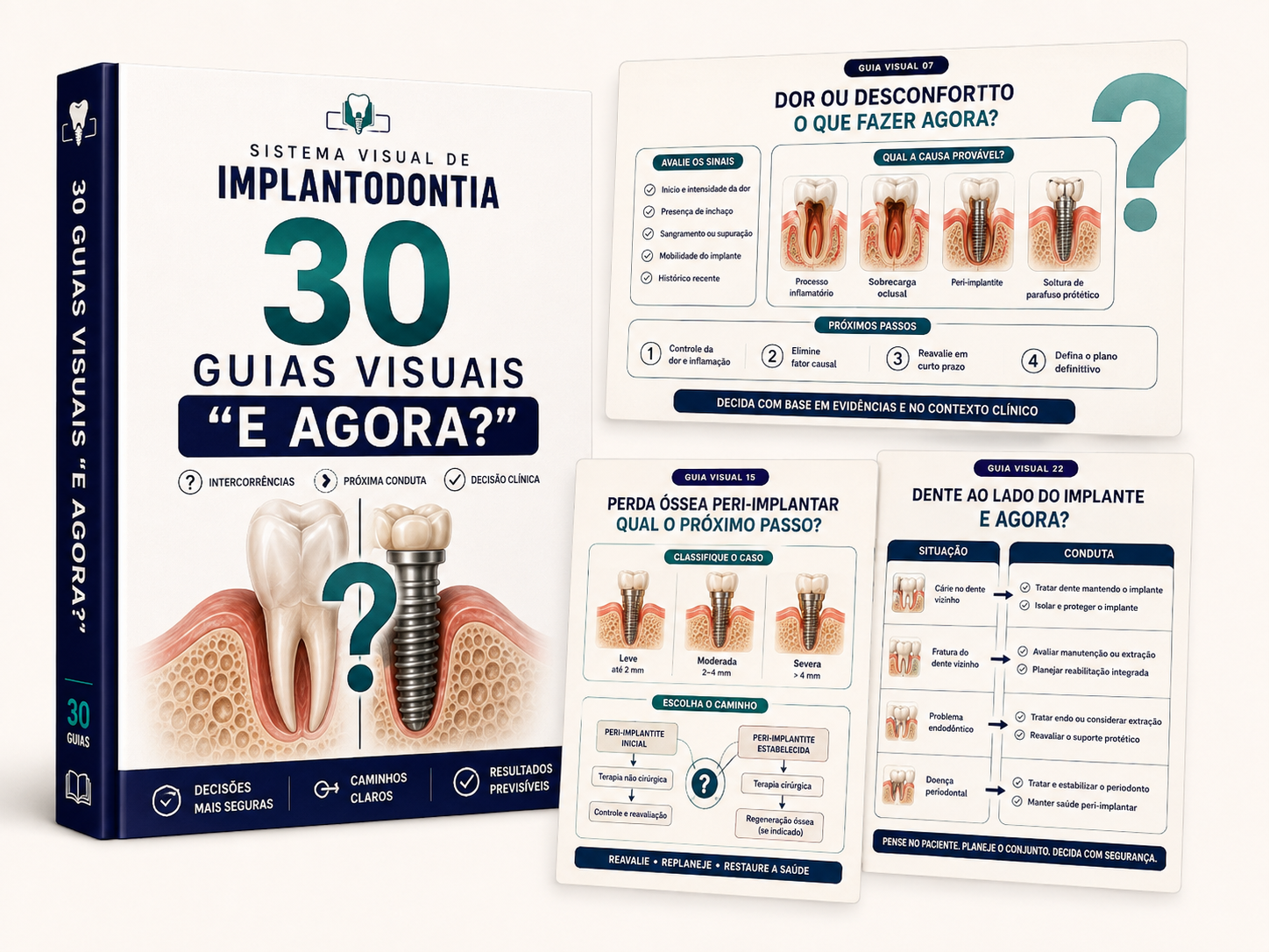 Guias E Agora de Implantodontia